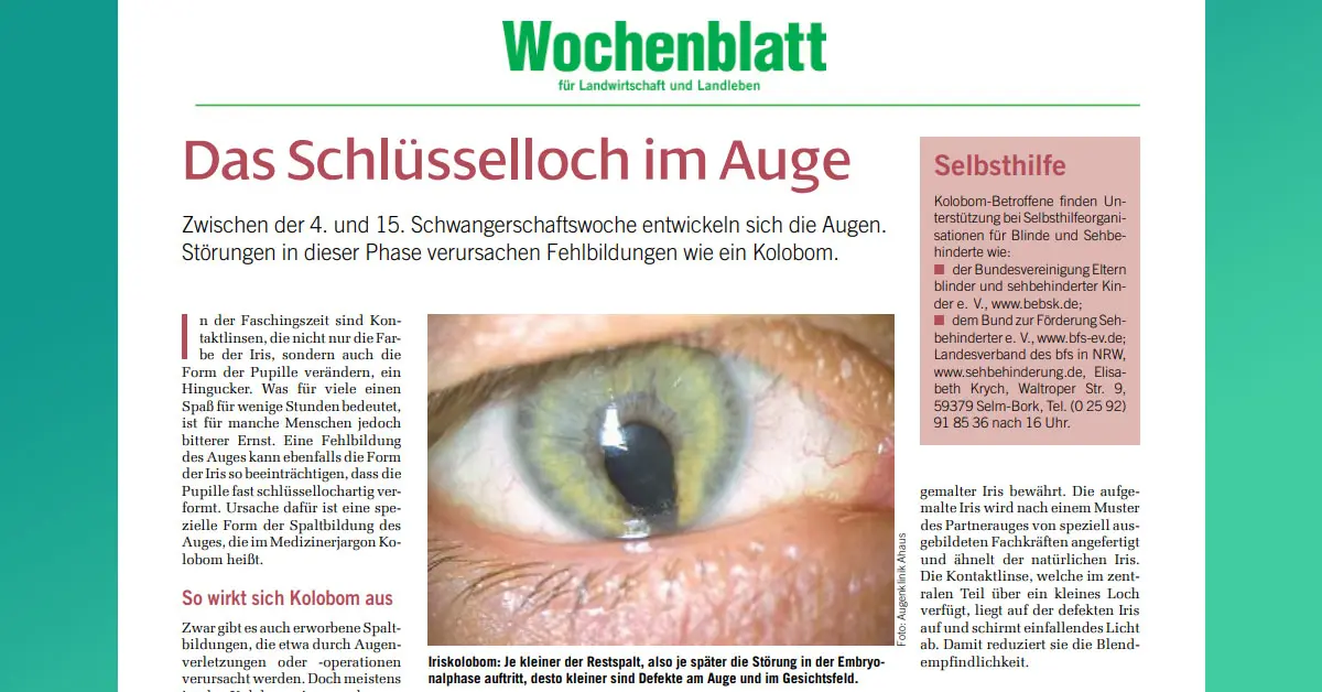 Das Schl Sselloch Im Auge Augen Rzte Gerl Kollegen Augenklinik De